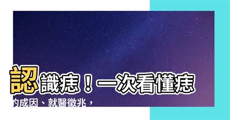 痣 生成原因|痣是什麼？一次了解痣原因、就醫時機以及如何改善